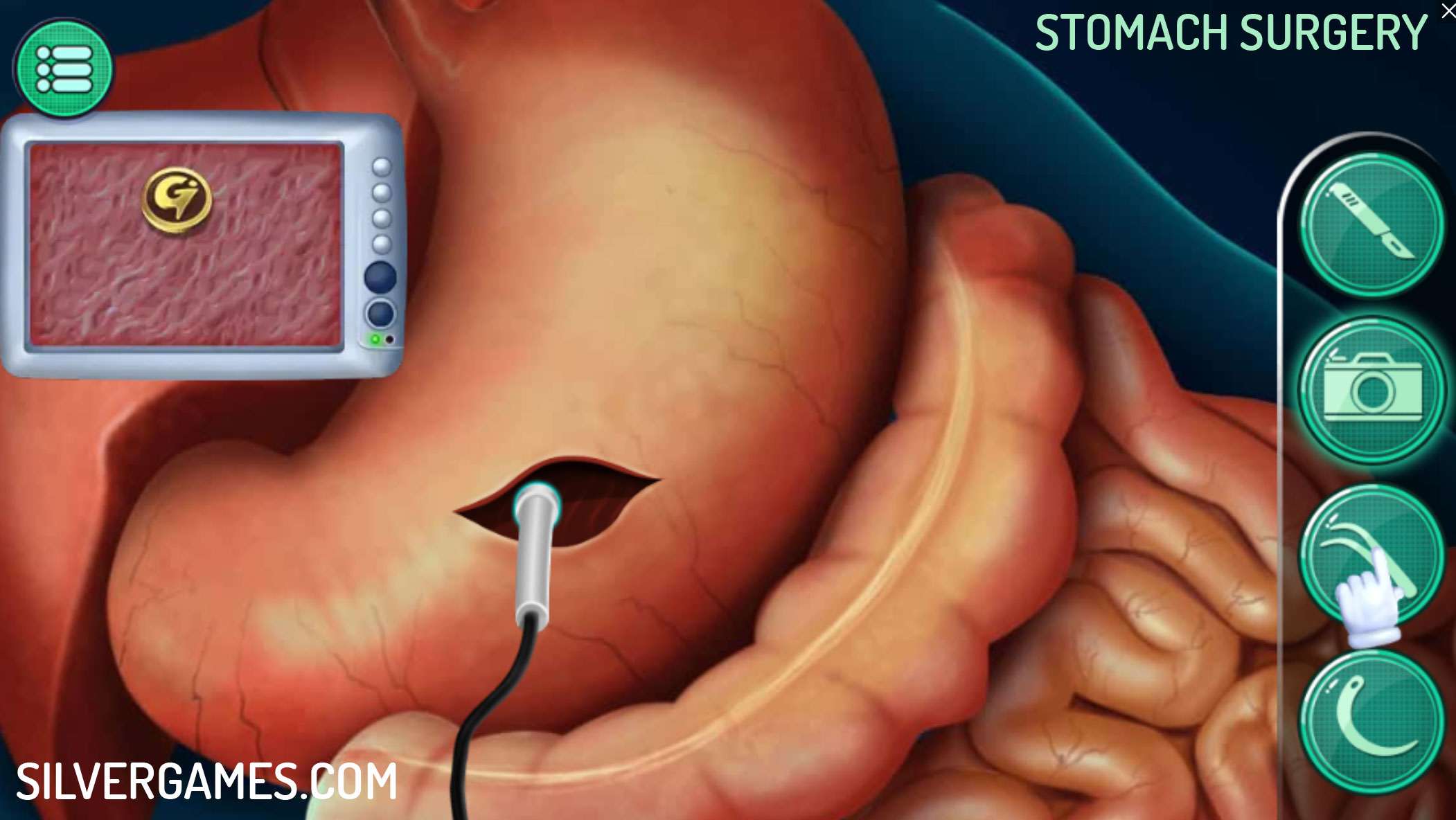 OPERATE NOW: STOMACH SURGERY jogo online gratuito em